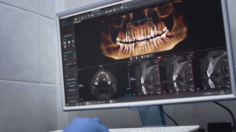 TMJ/TMD Treatment in Butler, AL